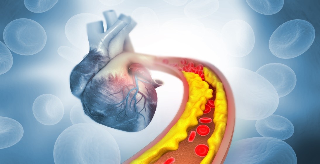 Cholesterol v cievach