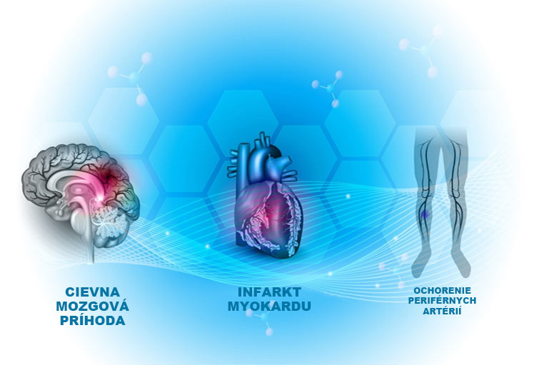 Ochorenie srdca a cholesterol